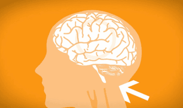 [Organ Donation] What is meant by brain death?
