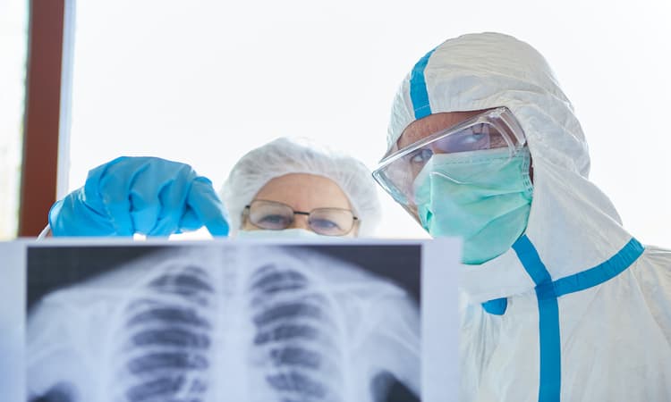 Dutch companies develop method of diagnosing COVID-19 using x-rays