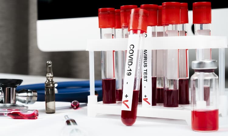 Many more coronavirus tests were available than were used