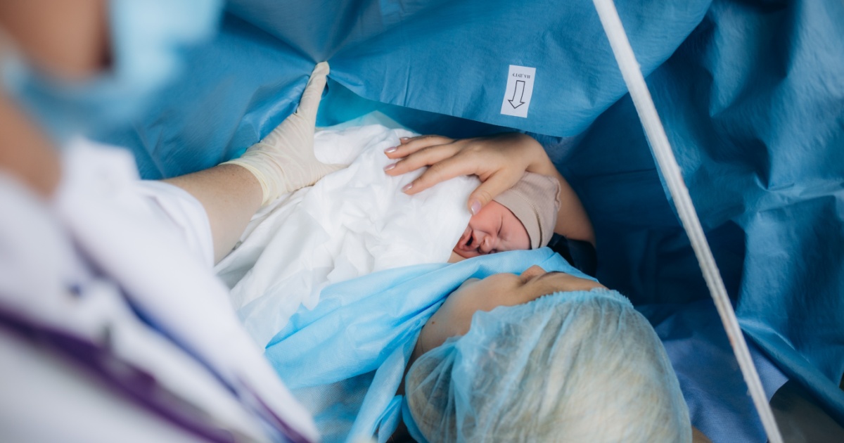 C Section